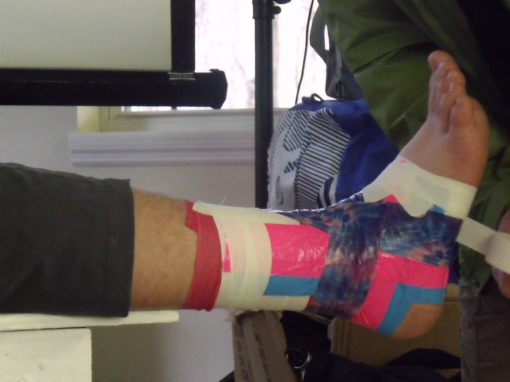 Pete demonstrates ankle taping